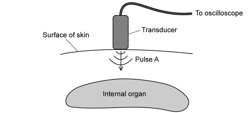 q4a_travelling-waves_ib-sl-physics-sq-medium