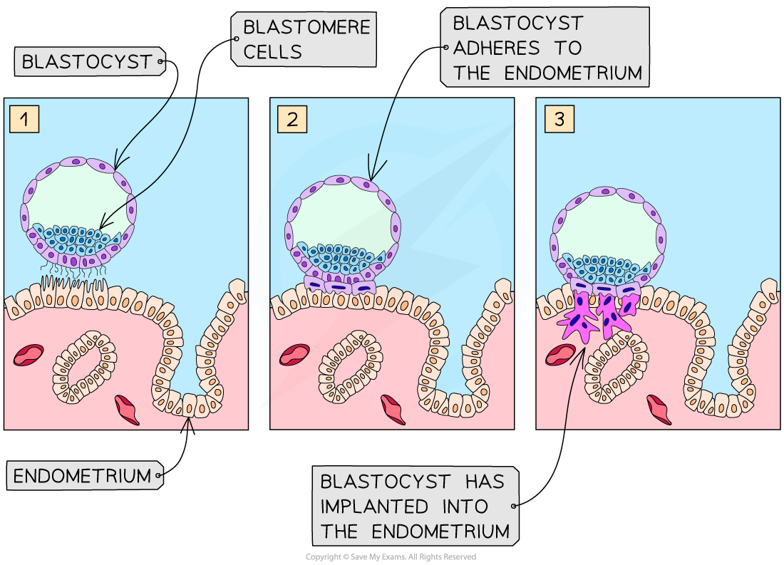 implantation-of-blastocyst