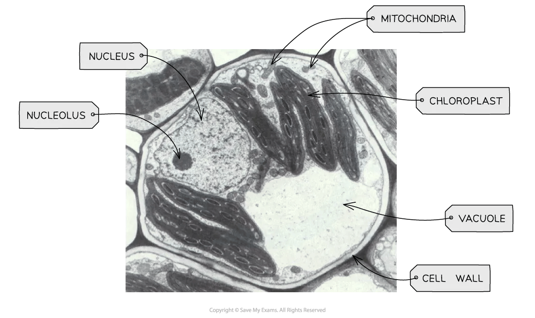 plant-cell-electron-micrograph