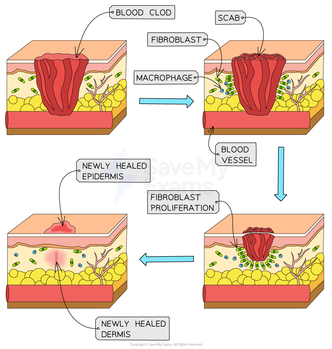 wound-healingwound-healing