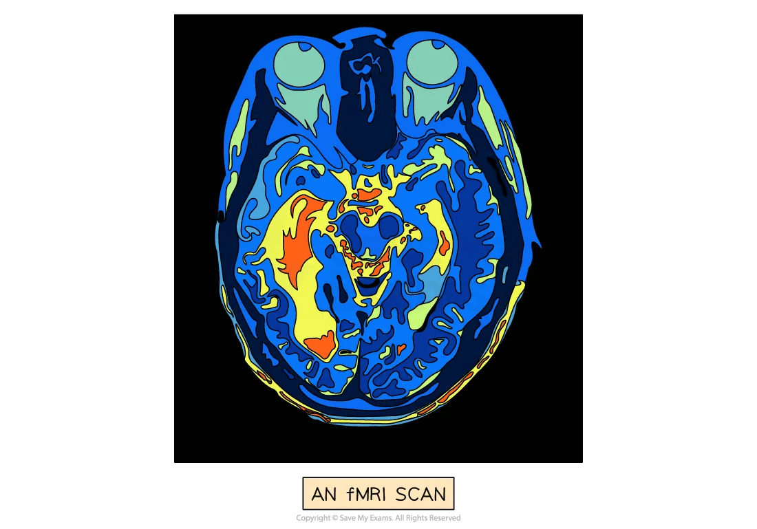 fmri-pet-scans2-for-ib-psychology