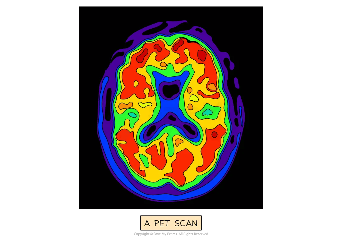 fmri-pet-scans3-for-ib-psychology