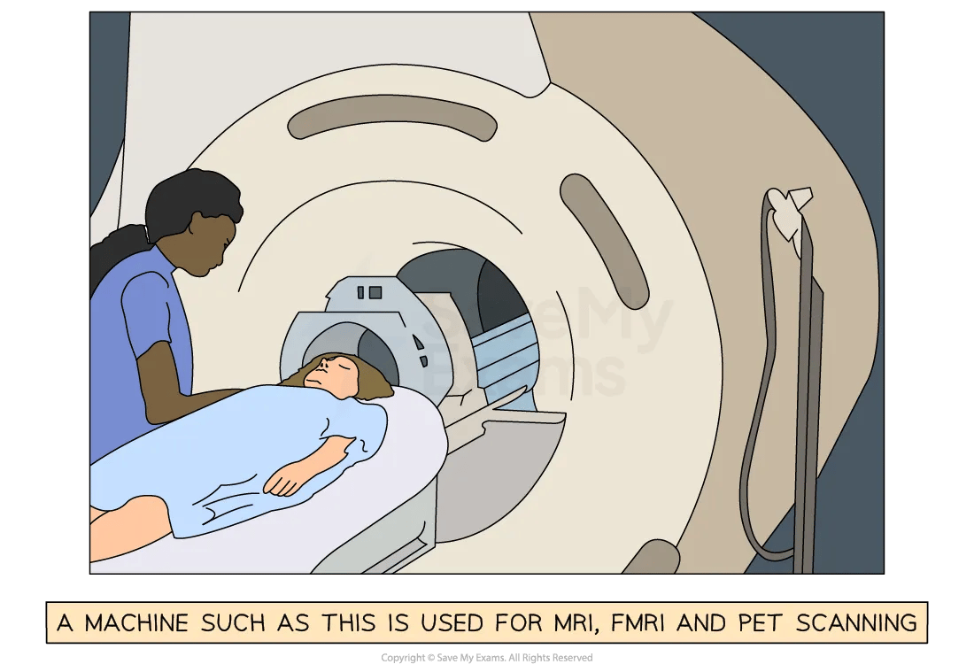 mri-brain-scan-for-ib-psychology