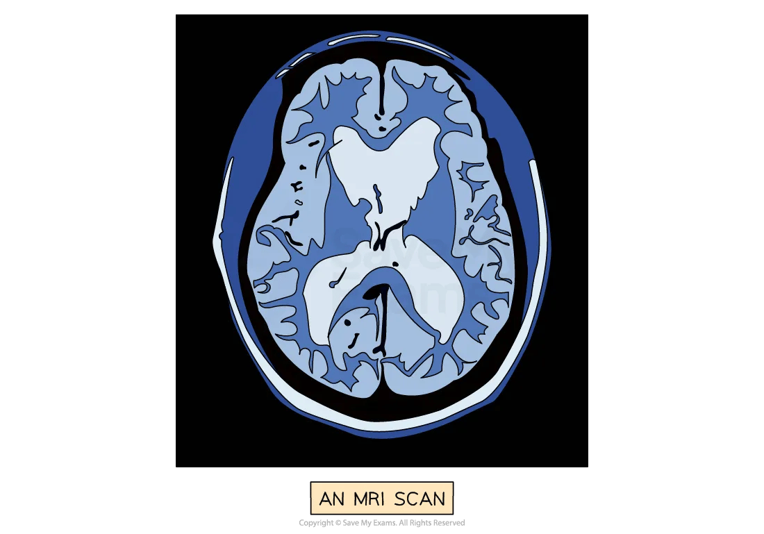 mri-brain-scan2-for-ib-psychology