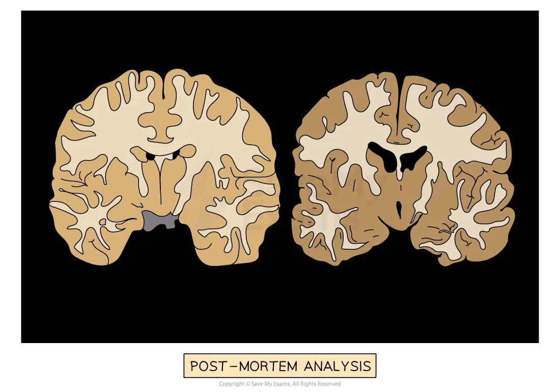 overview-techniques-to-study-the-brain-05-for-ib-psychology