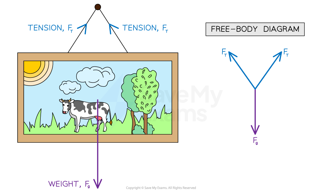 tension-free-body-diagram